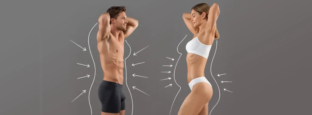 Liposuction
